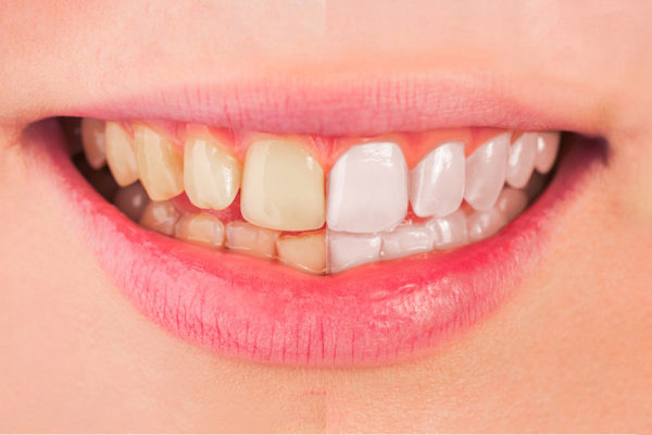 blanchir-dents-photoshop